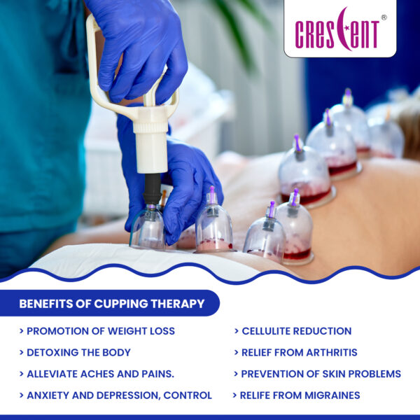 crescent hijama cupping therapy doctor benefits