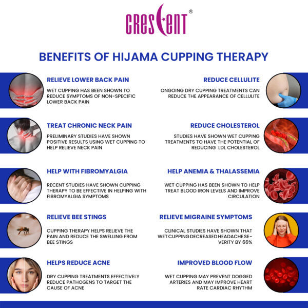 crescent hijama Chinese cupping therapy benefits