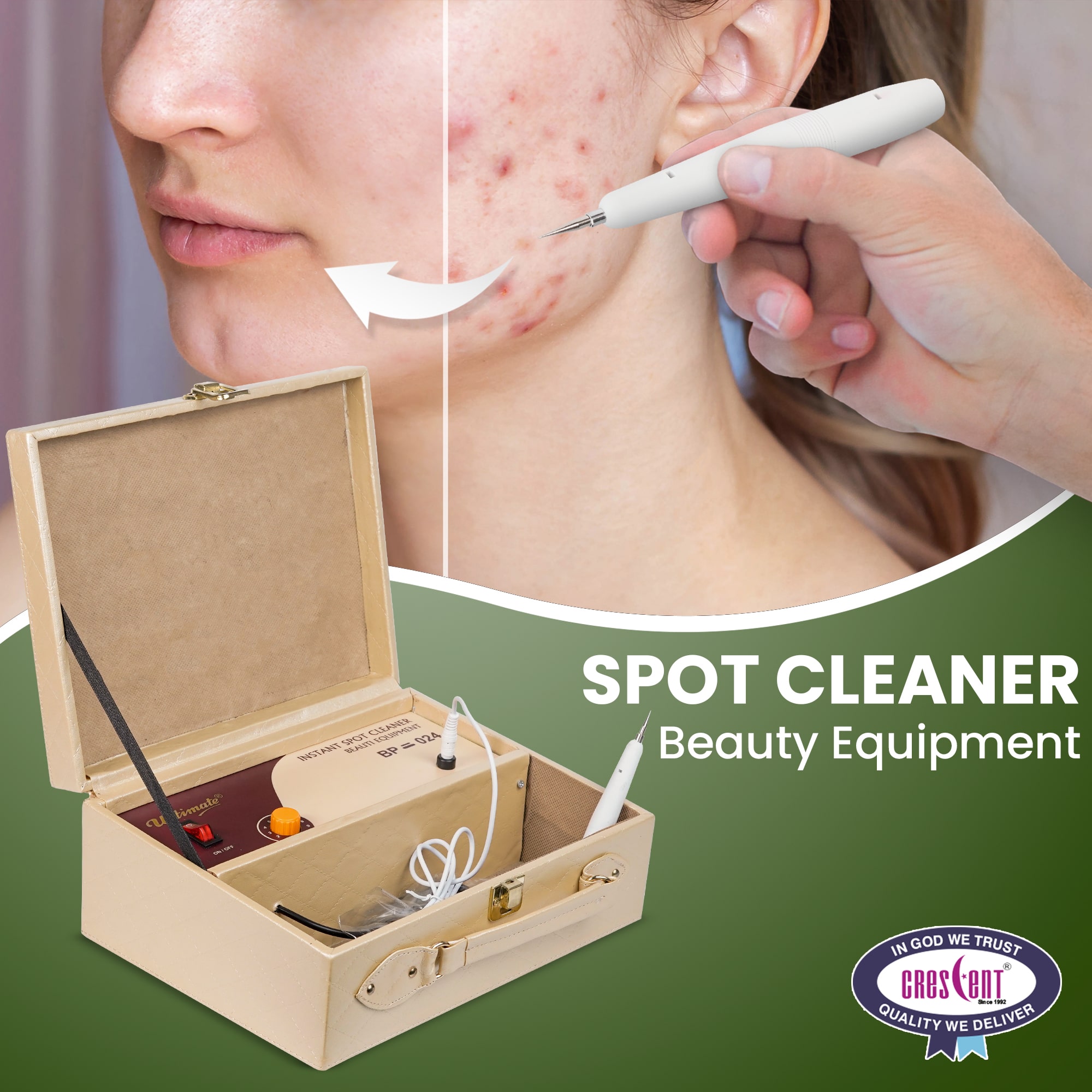 Ultimate Spot Cleaner, Peti